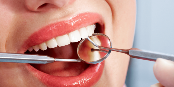 Bocca aperta di donna durante una visita dentistica con sonda e specchietto