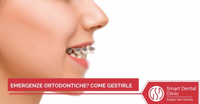 come-gestire-emergenze-ortodontiche Ragazza che sorride con apparecchio fisso ai denti in primo piano