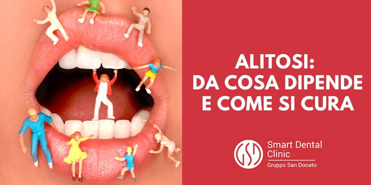 Quali sono le cause ed i rimedi dell’alitosi? Smart Dental Clinic