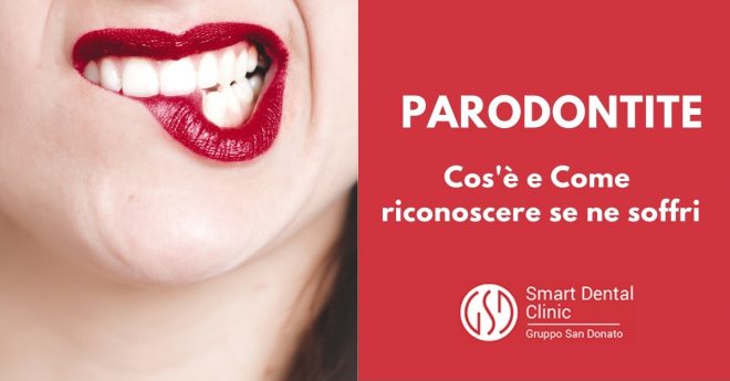 bocca di donna con rossetto rosso che si morsica il labbro inferiore