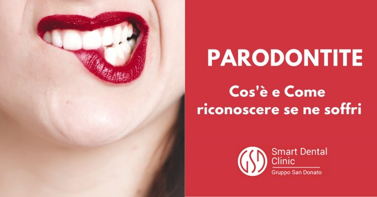 bocca di donna con rossetto rosso che si morsica il labbro inferiore