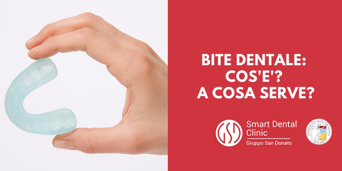 bite-dentale-cosa-serve mano che tiene un bite dentale