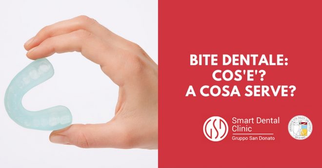 bite-dentale-cosa-serve mano che tiene un bite dentale