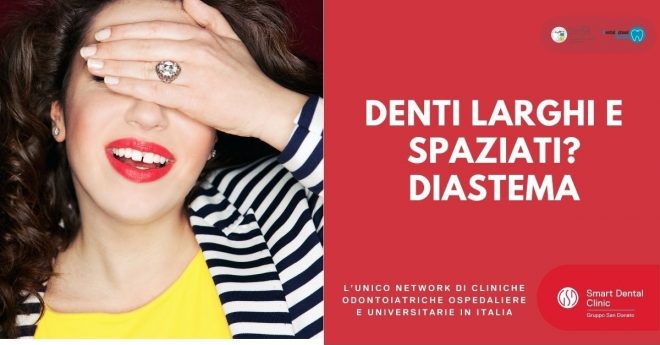 diastema-denti-larghi Ragazza che sorride coprendosi gli occhi e mostrando i denti affetti da diastema