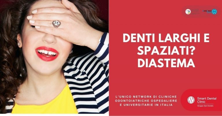 Ragazza che sorride coprendosi gli occhi e mostrando i denti affetti da diastema