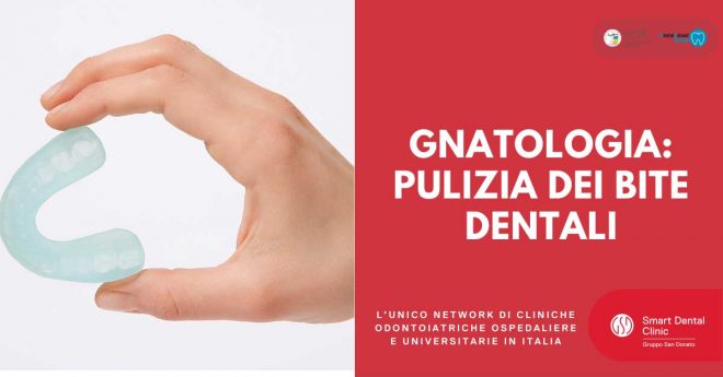 come-pulire-bite-dentali Mano che tiene un bite dentale