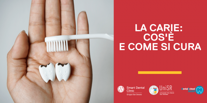 CARIE-cos’è-come-sicura mano che tiene il modellino di due denti cariati e uno spazzolino