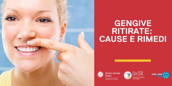 gengive-ritirate ragazza che si osserva le gengive