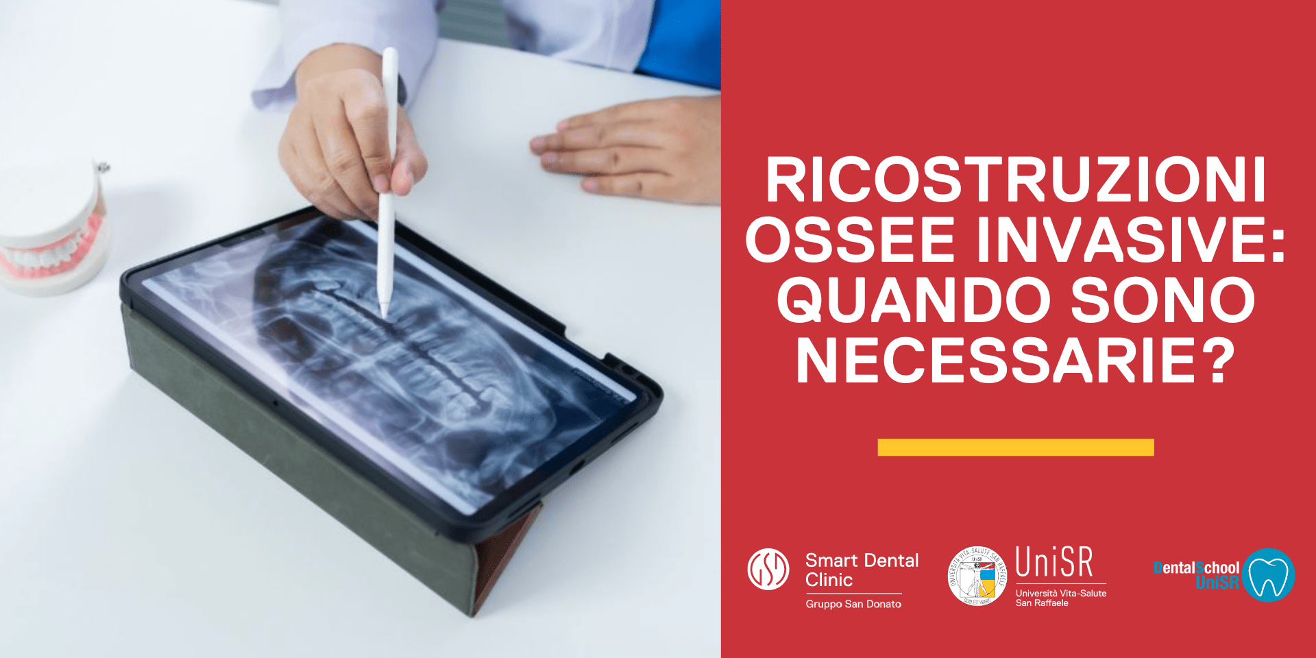 RICOSTRUZIONI OSSEE QUANDO SONO NECESSARIE Dentista che mostra l'immagine di una ricostruzione ossea da un tablet