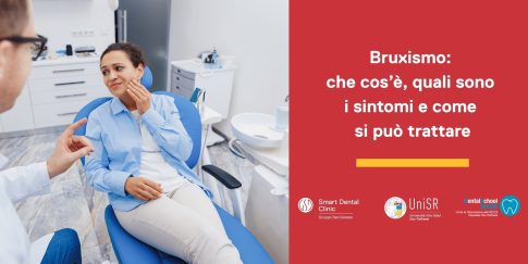 bruxismo-bite-dentale